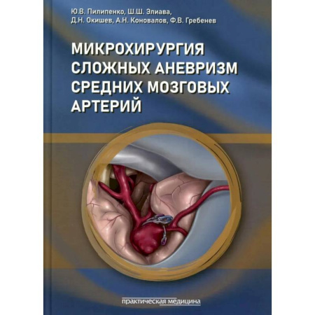 Хирургия. Ортопедия, книга Микрохирургия сложных аневризм средних мозговых артерий: гигантских, фузиформных и частично тромбированных купить по низкой цене