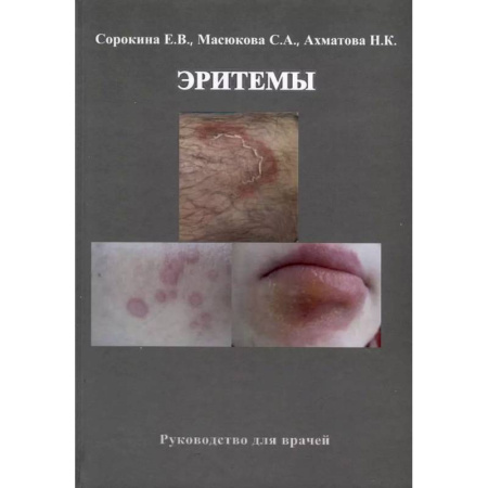 Кожные и венерические болезни, книга Эритемы. Руководство для врачей купить по низкой цене