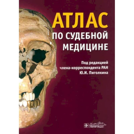Криминал, книга Атлас по судебной медицине купить по низкой цене
