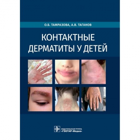 Отдельные виды заболеваний у детей, книга Контактные дерматиты у детей купить по низкой цене