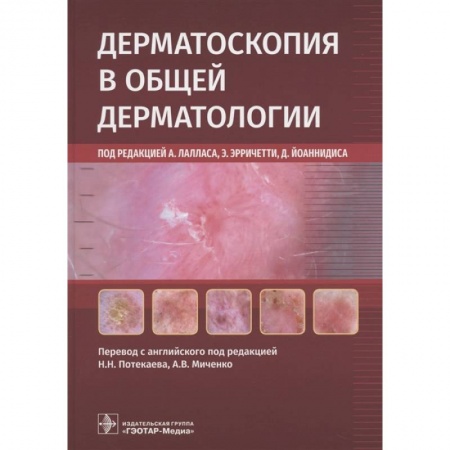 Кожные и венерические болезни, книга Дерматоскопия в общей дерматологии купить по низкой цене