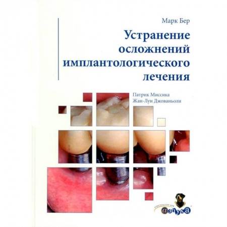 Стоматология, книга Устранение осложнений имплантологического лечения купить по низкой цене