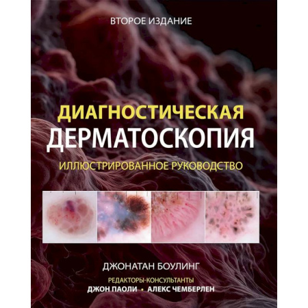 Кожные и венерические болезни, книга Диагностическая дерматоскопия: иллюстрированное руководство купить по низкой цене