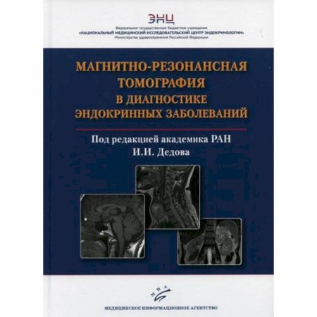 УЗИ. ЭКГ. Томография. Рентген, книга Магнитно-резонансная томография в диагностике эндокринных заболеваний купить по низкой цене