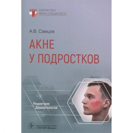 Книги, книга Акне у подростков купить по низкой цене