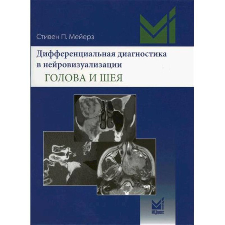Позвоночник. Суставы. Артрит. Остеохондроз, книга Дифференциальная диагностика в нейровизуализации. Голова и шея купить по низкой цене