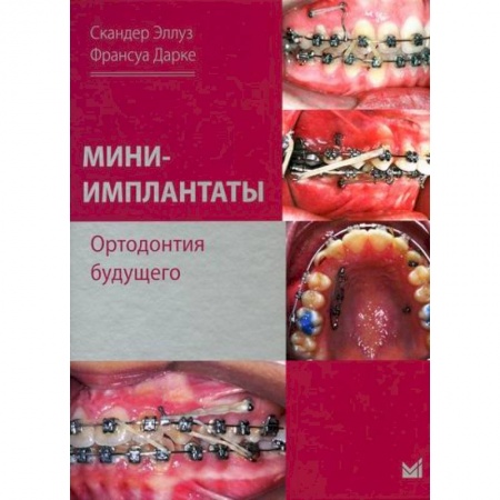 Стоматология, книга Мини-имплантаты. Ортодонтия будущего купить по низкой цене