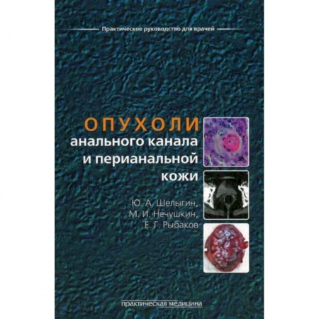 Онкология, книга Опухоли анального канала и перианальной кожи купить по низкой цене