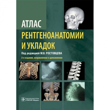УЗИ. ЭКГ. Томография. Рентген, книга Атлас рентгеноанатомии и укладок.Руководство для врачей купить по низкой цене