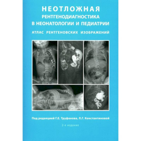 Другие виды специальной медицины, книга Неотложная рентгенодиагностика в неонатологии и педиатрии. Атлас рентгеновских изображений. Учебное пособие купить по низкой цене