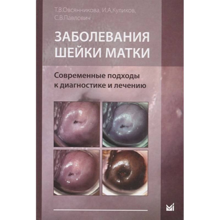 Онкология, книга Заболевания шейки матки. Современные подходы к диагностике и лечению купить по низкой цене