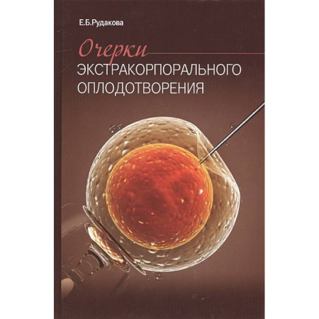 Акушерство и гинекология, книга Очерки экстракорпорального оплодотворения купить по низкой цене