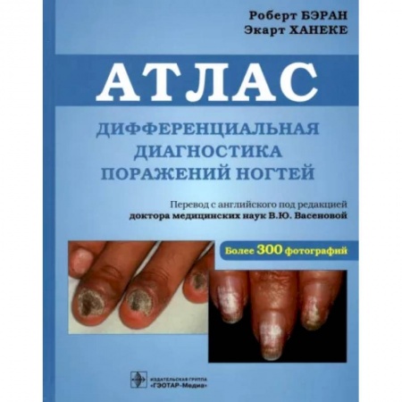 Другие виды специальной медицины, книга Дифференциальная диагностика поражен ногтей. Атлас купить по низкой цене