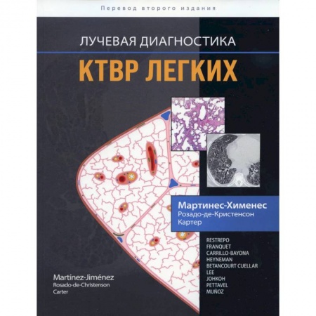 Книги, книга Лучевая диагностика. КТВР легких купить по низкой цене