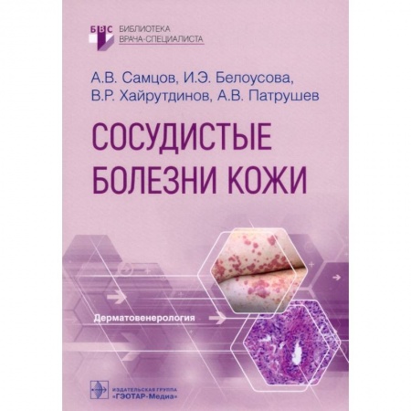 Медицина. Фармакология, книга Сосудистые болезни кожи купить по низкой цене