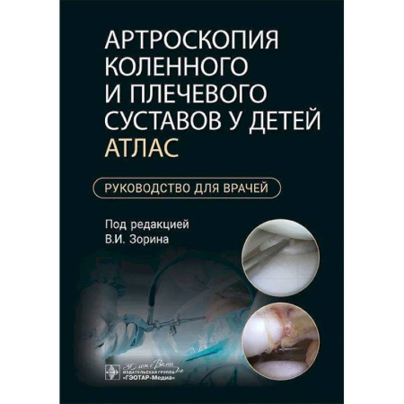 Хирургия. Ортопедия, книга Артроскопия коленного и плечевого суставов у детей. Атлас : руководство для врачей купить по низкой цене