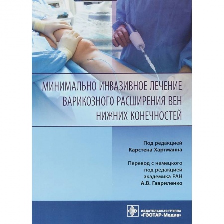 Хирургия. Ортопедия, книга Минимально инвазивное лечение варикозного расширения вен купить по низкой цене