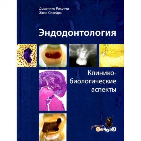 Стоматология, книга Эндодонтология. Клинико-биологические аспекты купить по низкой цене