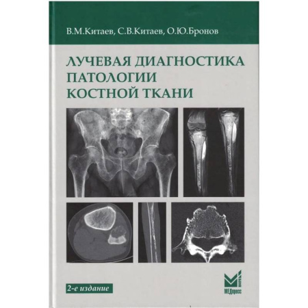 Медицинские энциклопедии и справочники, книга Лучевая диагностика патологии костной ткани купить по низкой цене