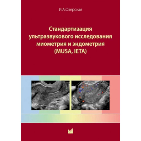 Акушерство и гинекология, книга Стандартизация ультразвукового исследования миометрия и эндометрия (MUSA, IETA). Учебное пособие купить по низкой цене