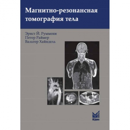 УЗИ. ЭКГ. Томография. Рентген, книга Магнитно-резонансная томография тела купить по низкой цене