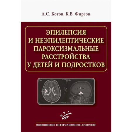 Другие виды специальной медицины, книга Эпилепсия и неэпилептические пароксизмальные расстройства у детей и подростков купить по низкой цене