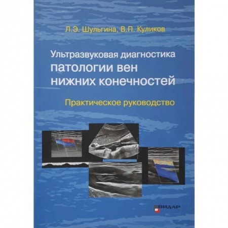 УЗИ. ЭКГ. Томография. Рентген, книга Ультразвуковая диагностика патологии вен нижних конечностей: практическое руководство купить по низкой цене