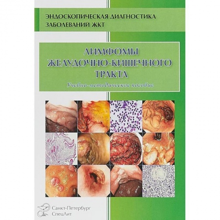 Онкология, книга Лимфомы желудочно-кишечного тракта. Учебно-методическое пособие купить по низкой цене