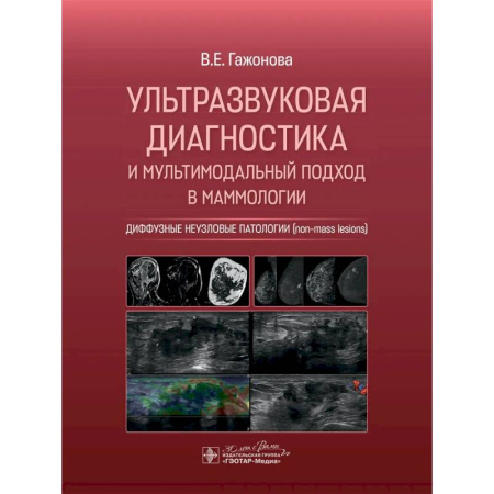 Медицинские энциклопедии и справочники, книга Ультразвуковая диагностика и мультимодальный подход в маммологии. Диффузные неузловые патологии купить по низкой цене