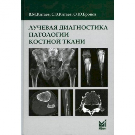 УЗИ. ЭКГ. Томография. Рентген, книга Лучевая диагностика патологии костной ткани купить по низкой цене