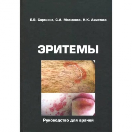 Кожные и венерические болезни, книга Эритемы. Руководство для врачей купить по низкой цене