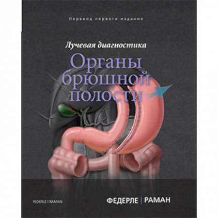 Внутренние болезни. Диагностика, книга Лучевая диагностика. Органы брюшной полости купить по низкой цене