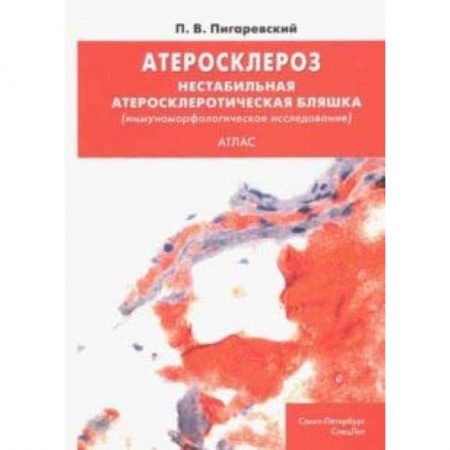 Кардиология, книга Атеросклероз. Нестабильная атеросклеротическая бляшка (иммуноморфологическое исследование). Атлас купить по низкой цене