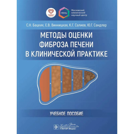 Гастроэнтерология, книга Методы оценки фиброза печени в клинической практике купить по низкой цене