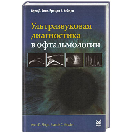 УЗИ. ЭКГ. Томография. Рентген, книга Ультразвуковая диагностика в офтальмологии купить по низкой цене