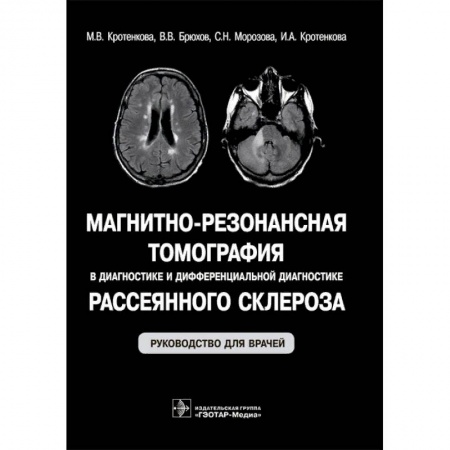УЗИ. ЭКГ. Томография. Рентген, книга Магнитно-резонансная томография в диагностике и дифференциальной диагностике рассеянного склероза купить по низкой цене