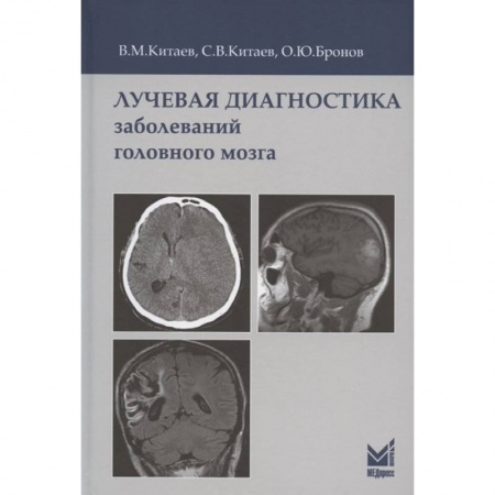 УЗИ. ЭКГ. Томография. Рентген, книга Лучевая диагностика заболеваний головного мозга купить по низкой цене