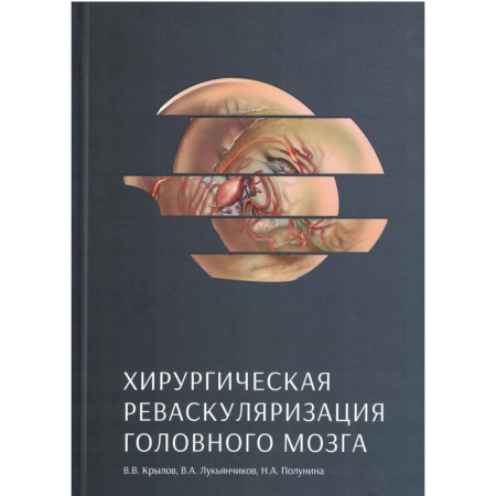 Медицинские энциклопедии и справочники, книга Хирургическая реваскуляризация головного мозга купить по низкой цене