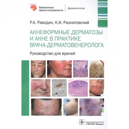 Медицина. Фармакология, книга Акнеформные дерматозы и акне в практике врача-дерматовенеролога: руководство для врачей купить по низкой цене