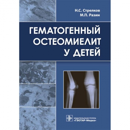 Медицина. Фармакология, книга Гематогенный остеомиелит у детей купить по низкой цене