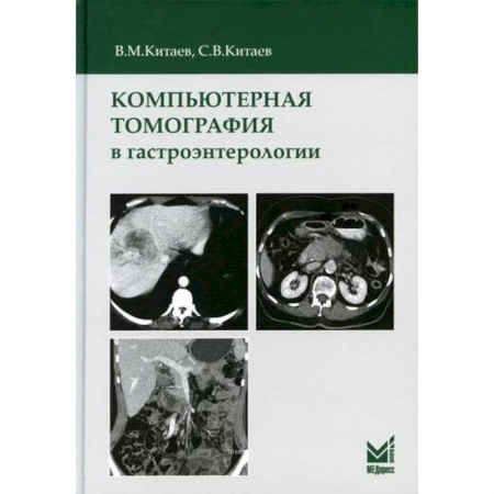 УЗИ. ЭКГ. Томография. Рентген, книга Компьютерная томография в гастроэнтерологии купить по низкой цене