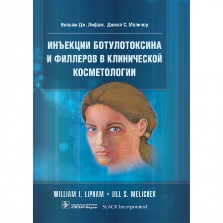 Кожные и венерические болезни, книга Инъекции ботулотоксина и филлеров в клинической косметологии купить по низкой цене