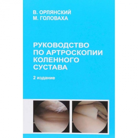 Хирургия. Ортопедия, книга Руководство по артроскопии коленного сустава купить по низкой цене