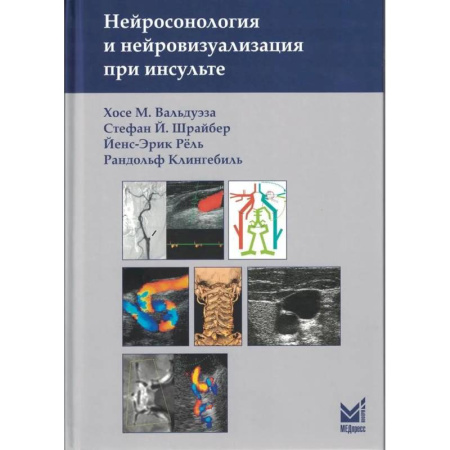 Кардиология, книга Нейросонология и нейровизуализация при инсульте купить по низкой цене