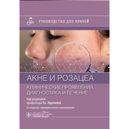 Диагностика. Терапии, книга Акне и розацеа. Клинические проявления, диагностика и лечение: руководство для врачей купить по низкой цене
