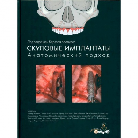 Стоматология, книга Скуловые имплантаты. Анатомический подход купить по низкой цене