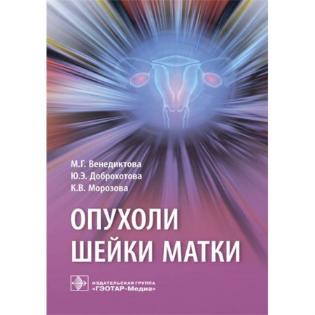Акушерство и гинекология, книга Опухоли шейки матки купить по низкой цене
