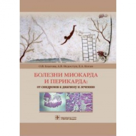 Кардиология, книга Болезни миокарда и перикарда. От синдромов к диагнозу и лечению купить по низкой цене