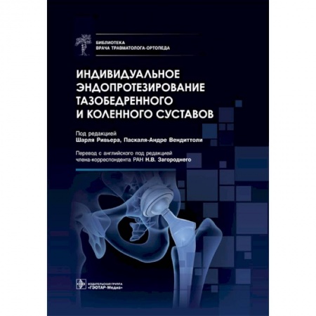 Книги, книга Индивидуальное эндопротезирование тазобедренного и коленного суставов купить по низкой цене