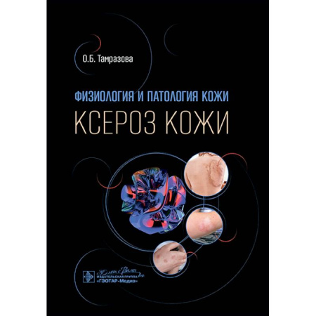 Кожные и венерические болезни, книга Физиология и патология кожи. Ксероз кожи купить по низкой цене